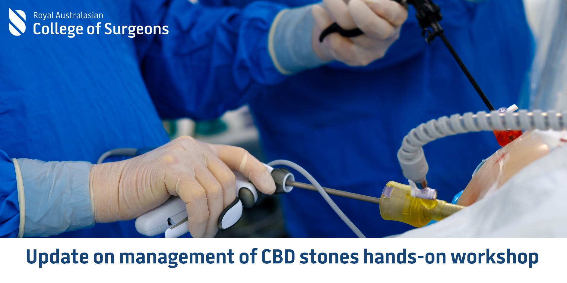 Update on management of CBD stones hands-on workshop banner